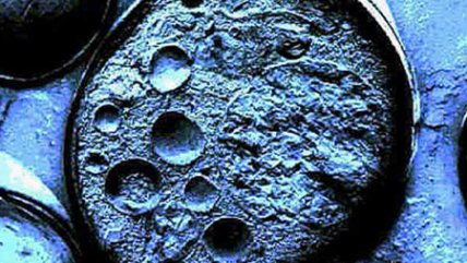 Hematólogo comentó posibilidades que abre la donación de cordones umbilicales