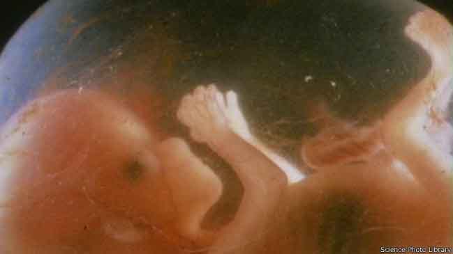  ¿Es posible diseñar seres humanos ecológicos?  