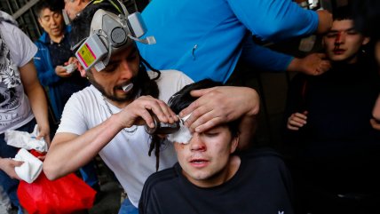  Colegio Médico critica a Carabineros por uso de balines  