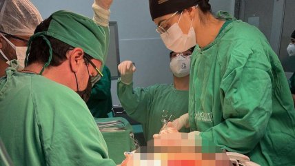   Médicos extraen tumor de 45 kilos de una mujer en Brasil 