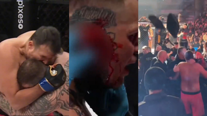   A lo Mike Tyson: Luchador mordió la oreja de su rival y causó escándalo en evento de MMA 