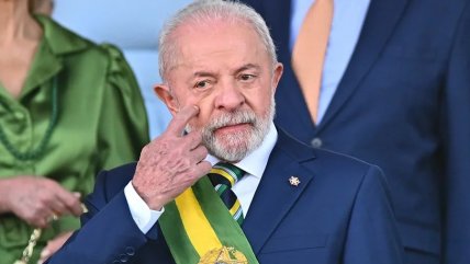   Lula inició tratamiento de radioterapia en el cuero cabelludo 